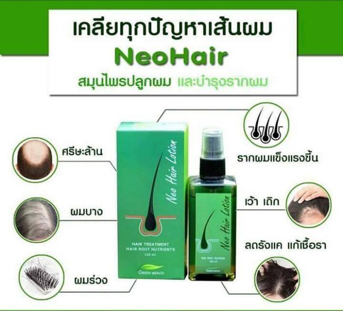 Neo Hair Lotion Hair Growth Solution Original Thaiproduct Murah
